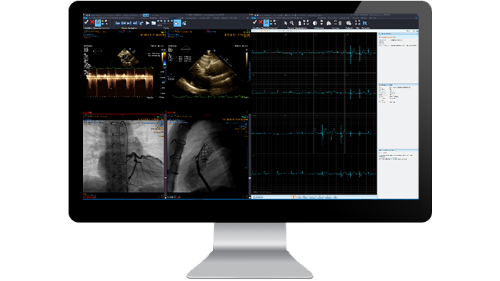 cardiology module interface screen on a monitor