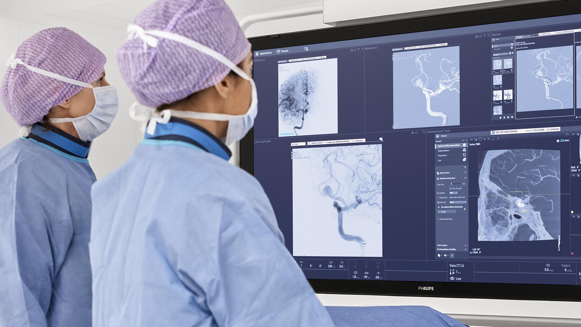 First patients in France and the USA enrolled in global WE-TRUST trial to accelerate stroke diagnosis and treatment